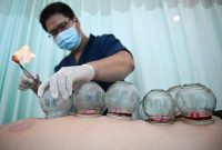 استقبال گردشگران خارجی از طب سنتی چین در سانیا